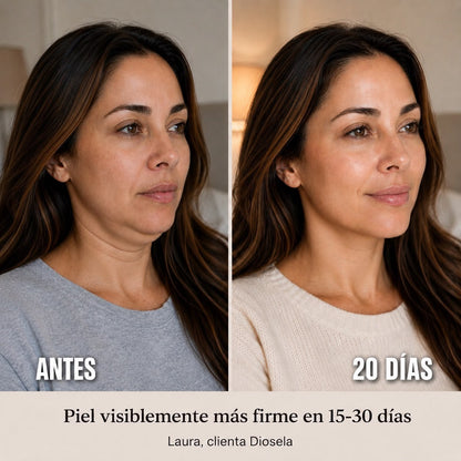 Banda facial modeladora de colágeno (Compra 1 y llévate 1 Gratis)